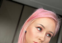 Psoriaas või dermatiit või hoopis mingi seenhaigus?