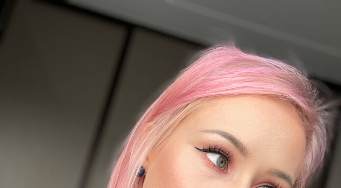 Psoriaas või dermatiit või hoopis mingi seenhaigus?