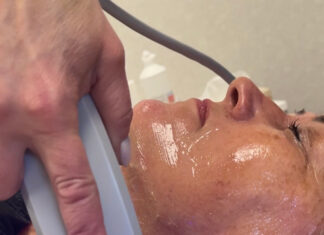 Lõtvunud naha pinguldamine kirurgilise sekkumiseta – HIFU smas lifting